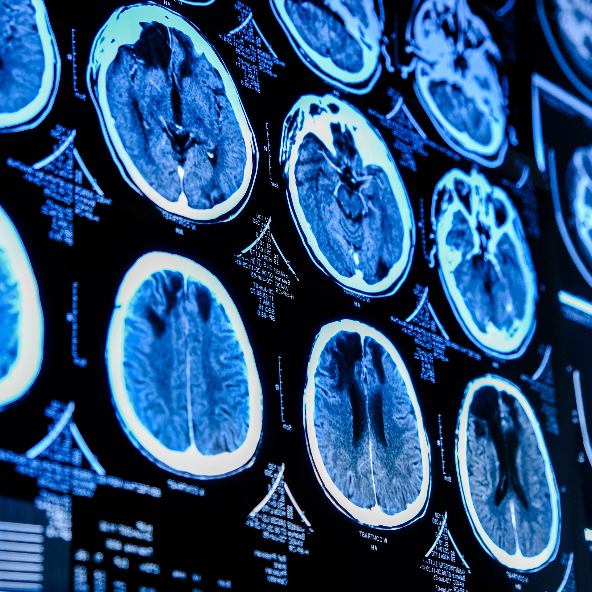 Neurology Care